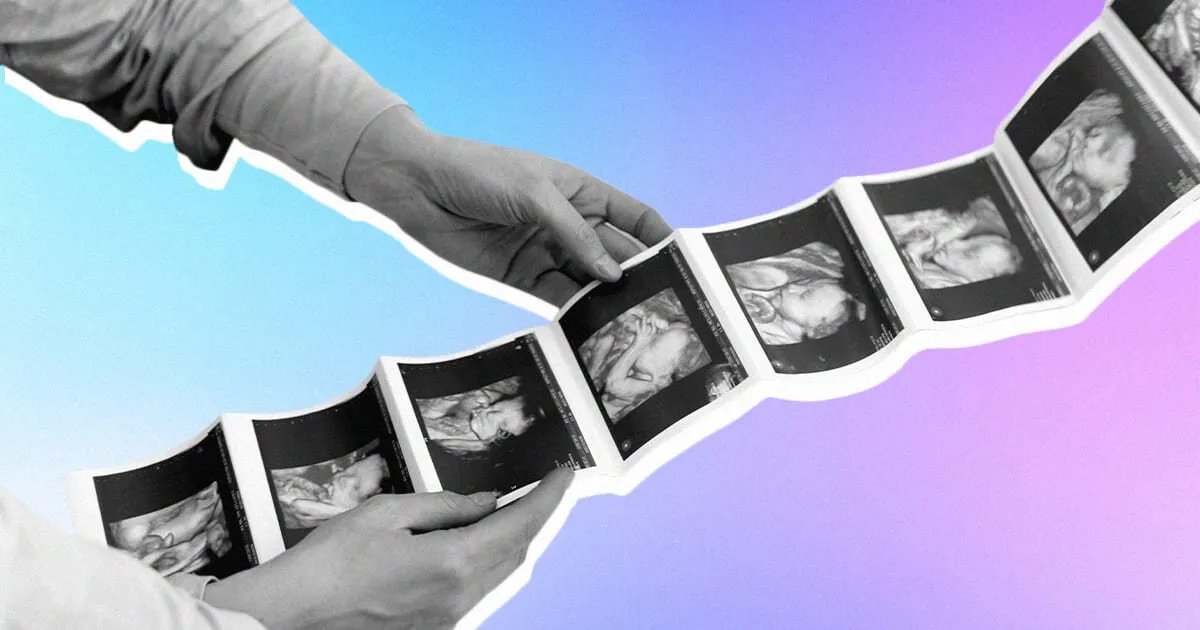 istoriya-sozdaniya-uzi-apparatov-snimki.jpg istoriya-sozdaniya-uzi-apparatov-snimki.jpg