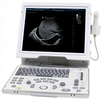 Портативный УЗИ аппарат Mindray DP-50 