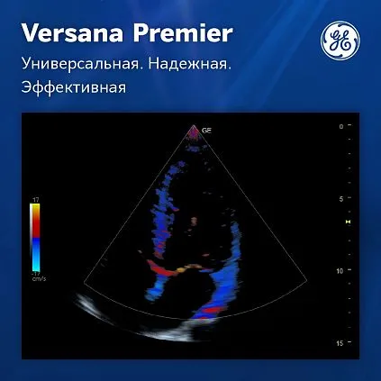 Клинические изображения УЗИ аппарат GE Versana Premier Platinum