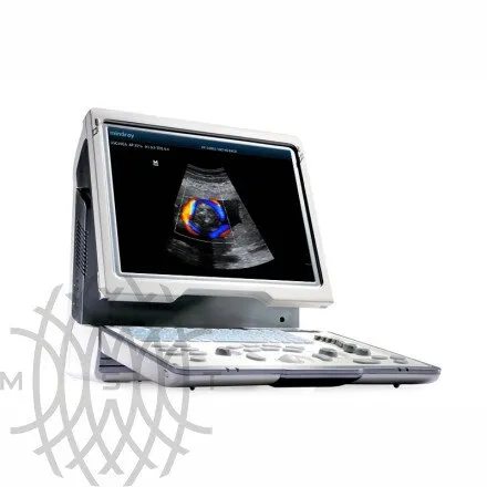 Mindray DP-50 Color портативный аппарат УЗИ