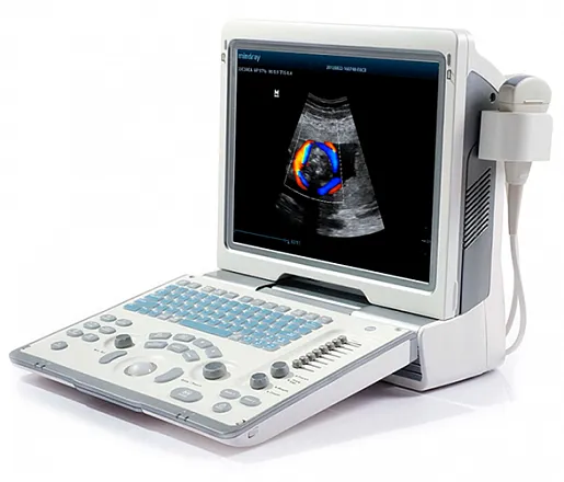 Mindray DP-50 Color портативный аппарат УЗИ