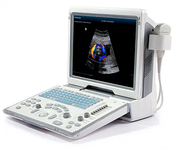 Портативный УЗИ аппарат Mindray DP-50 Color