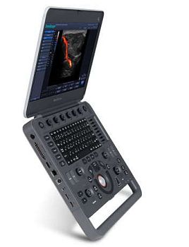Ультразвуковой аппарат Sonoscape S2N