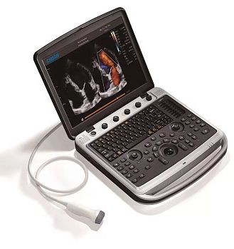 УЗИ аппарат Chison SonoBook 9 портативный