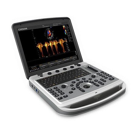 УЗИ аппарат Chison SonoBook 8 портативный