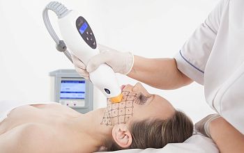 Монополярный RF-аппарат Solta Medical Inc. Thermage