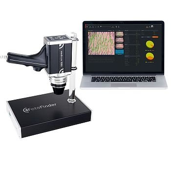 Аппарат для цифровой дерматоскопии FotoFinder medicam 1000 с док-станцией
